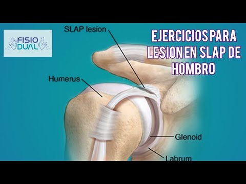 ¡Descubre cómo tratar la lesión de Slap en el hombro de forma efectiva!