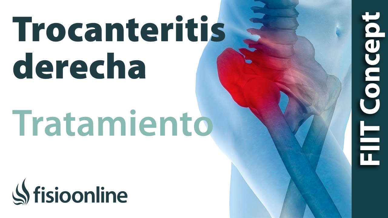 Descubre la postura ideal para sentarte con bursitis trocantérea