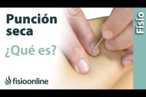 Terapia de Punción Seca: Guía Completa y Funcionamiento