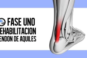 Rehabilitación eficaz para la tendinitis de Aquiles